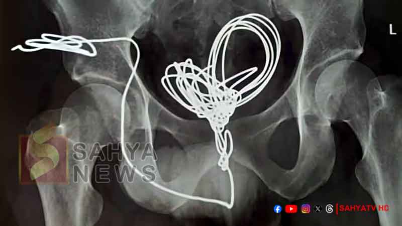 MUTHR
